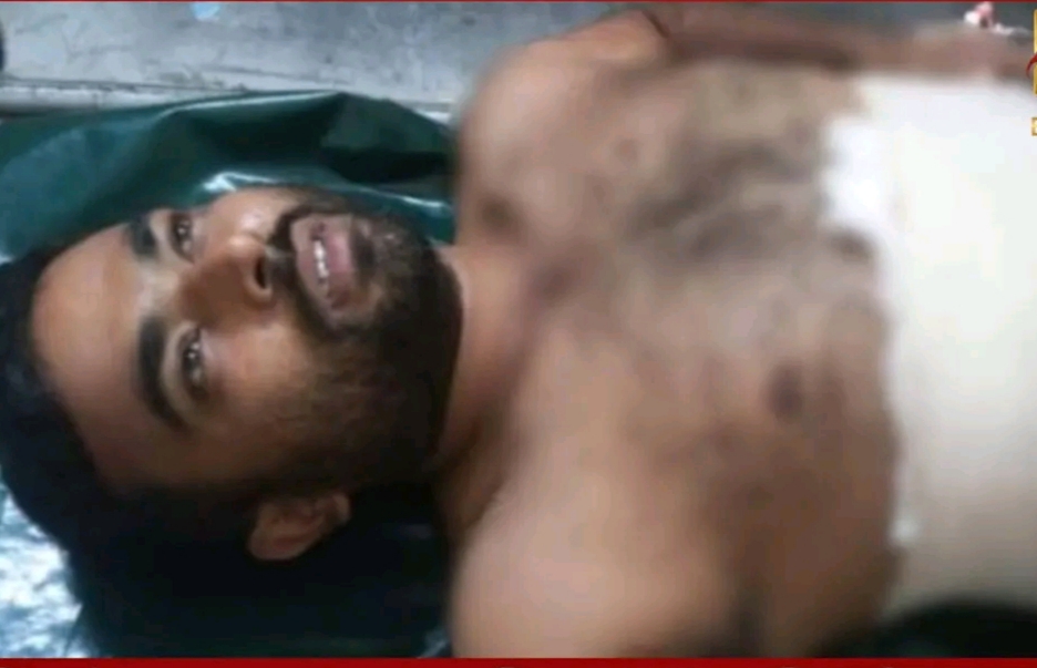 সীমান্তে বিএসএফের গুলিতে একজন বাংলাদেশী যুবক আহত