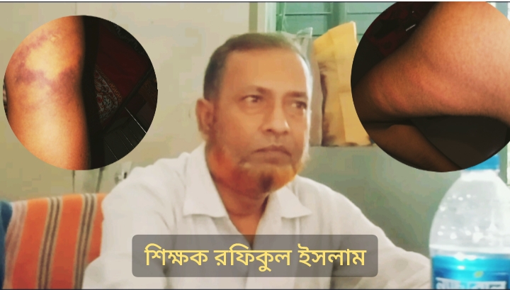শিক্ষার্থীদের অস্বাভাবিক বেত্রাঘাতের অভিযোগ শিক্ষকের বিরুদ্ধে!